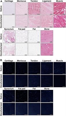 Potential of Soluble Decellularized Extracellular Matrix for Musculoskeletal Tissue Engineering – Comparison of Various Mesenchymal Tissues